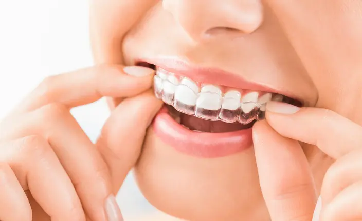 Accelerated Orthodontics
