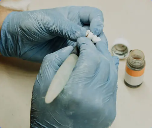 Dental Bridge Repair