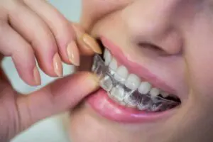 Learn the options for accelerated orthodontics in Gainesville, TX