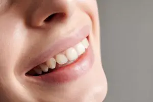 Discover how an orthodontist in Gainesville can help you straighten your teeth fast. 