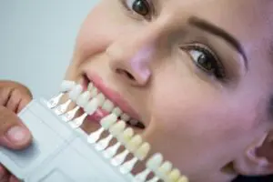 Ldarn where to find veneers in Gainesville