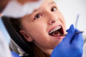 Learn the orthodontic options available for straightening your child's smile.