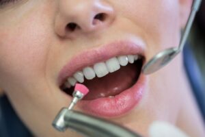 Learn how to care for dental implants with this handy guide