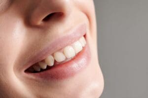 Discover how an orthodontist in Gainesville can help you straighten your teeth fast. 